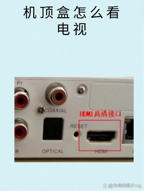 网络机顶盒用网线连还是wifi比较好