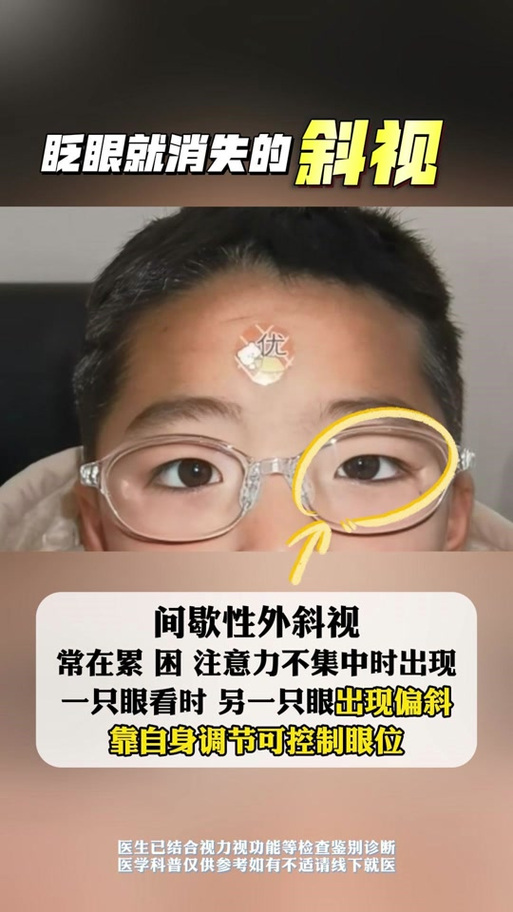 监控背面能监到吗