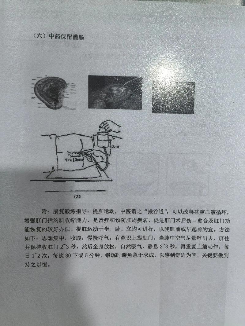 关于肛门的刑法
