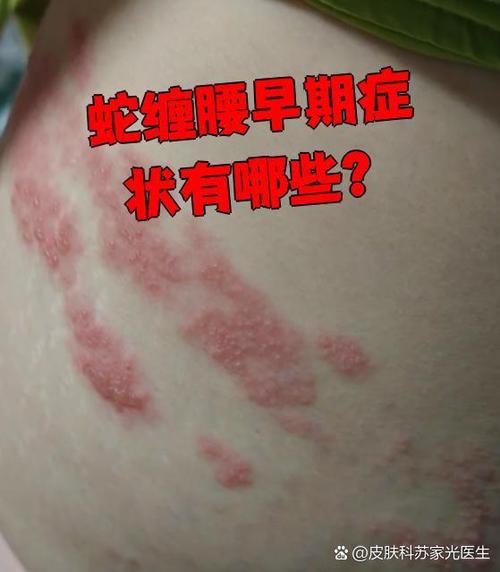 两个蛇缠绕是什么征兆