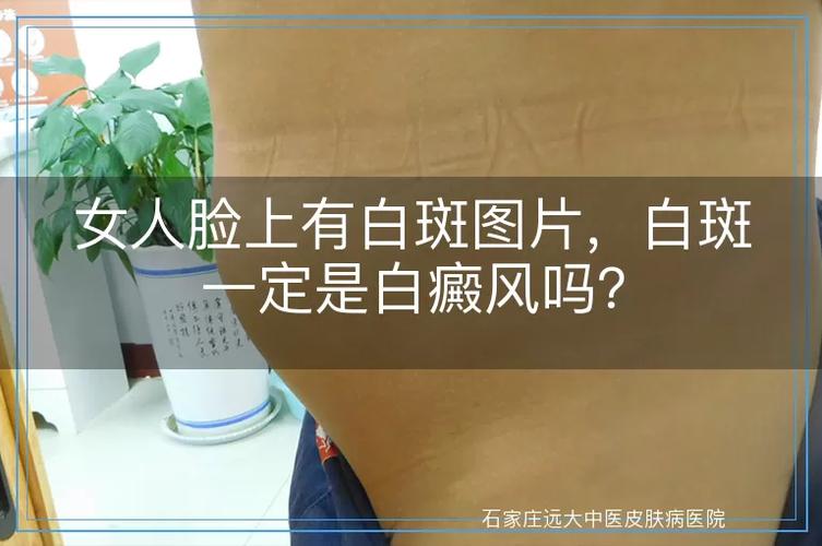 女性白斑是什么样子图片