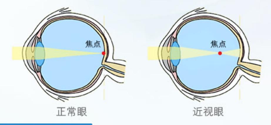 打开辅助功能