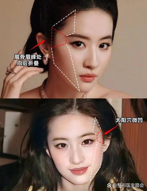 太阳穴填充用什么最好