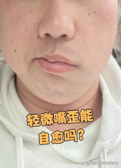 手机后置拍出来嘴巴是歪的
