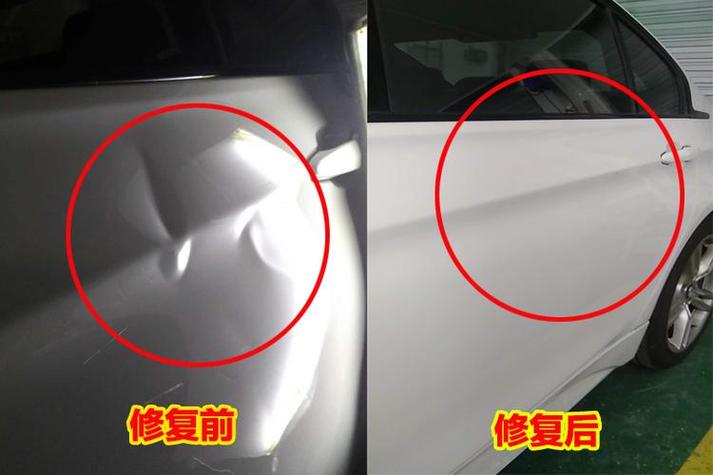 太阳凹陷填充胶原蛋白多少钱