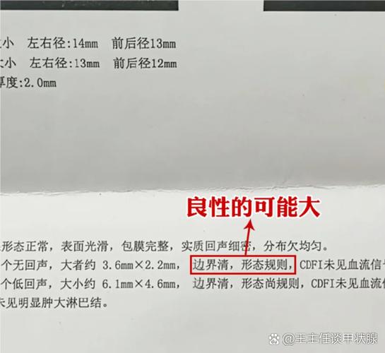 强回声是良性还是恶性